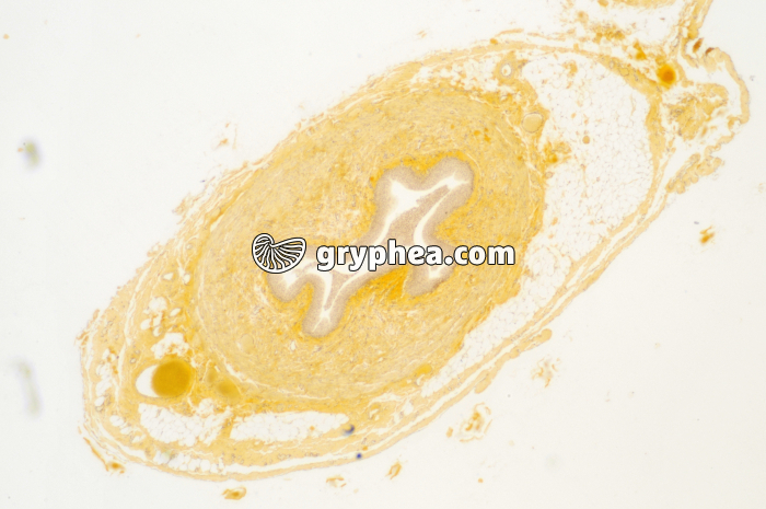 Urêtre muscle lisse x10 - gryphea.com